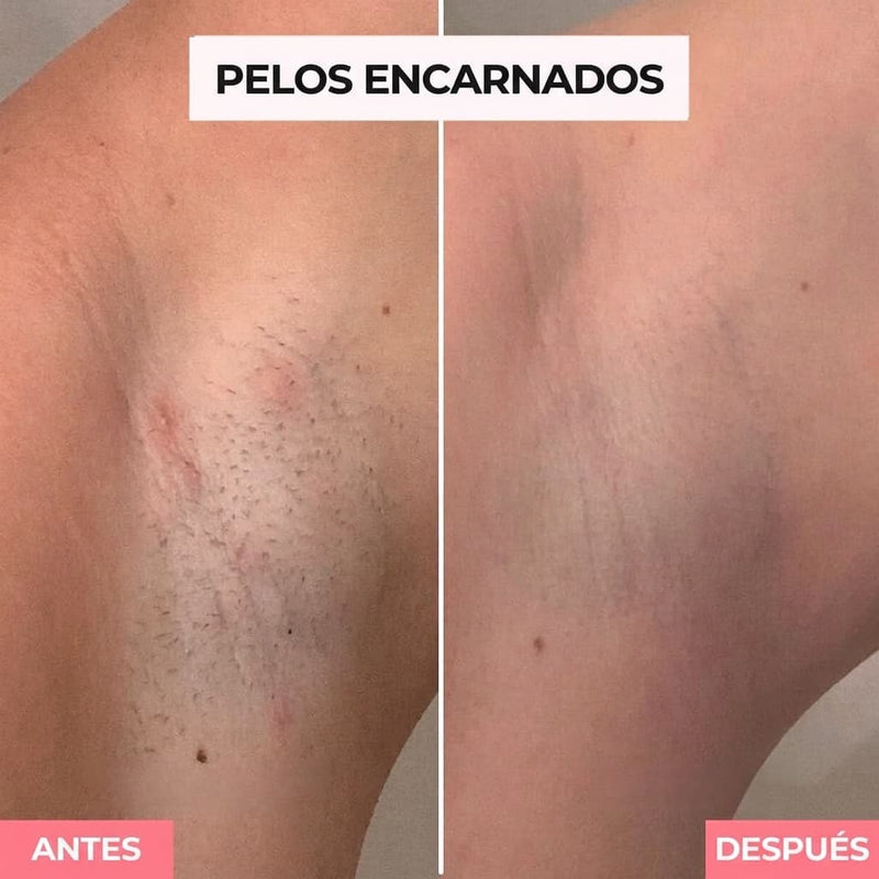 AXILAS