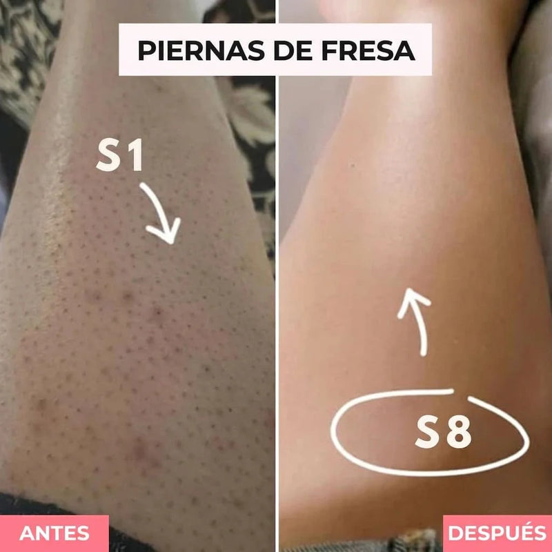 PIERNAS