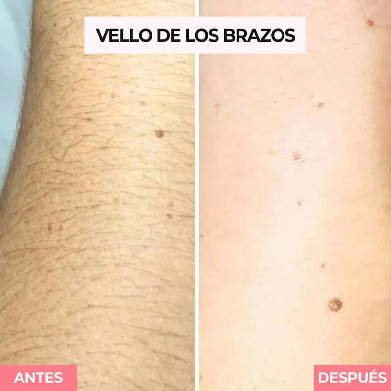 BRAZOS